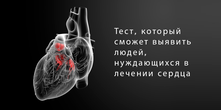 Тест, который сможет выявить людей, нуждающихся в лечении сердца