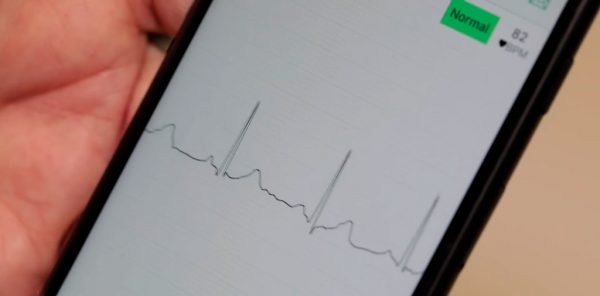 Ученые создали первый считыватель кардиограмм для умных часов
