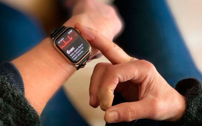 Функция ЭКГ в Apple Watch спасла человеку жизнь!