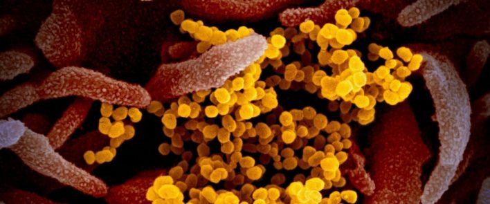 В США разработан «сверхранний» тест на коронавирус
