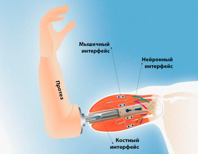 Управляемый разумом протез позволит ощущать прикосновения
