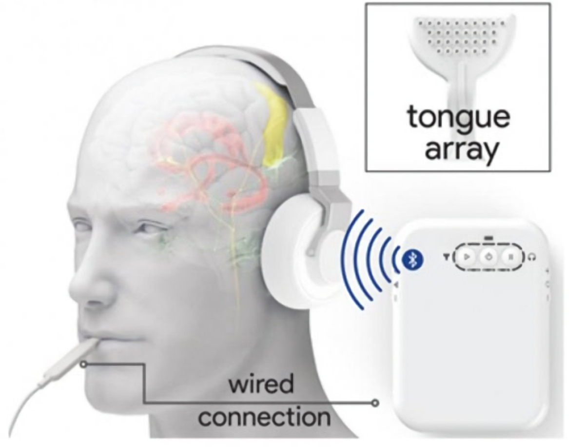 Лечение шума в ушах отзывы. Аппарат для подавления шума в ушах. Тиннитус шум в ушах. Электростимуляция ушей. Звуковая терапия от шума в ушах.