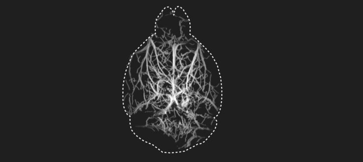 Новый метод сканирования мозга привёл к открытиям в неврологии