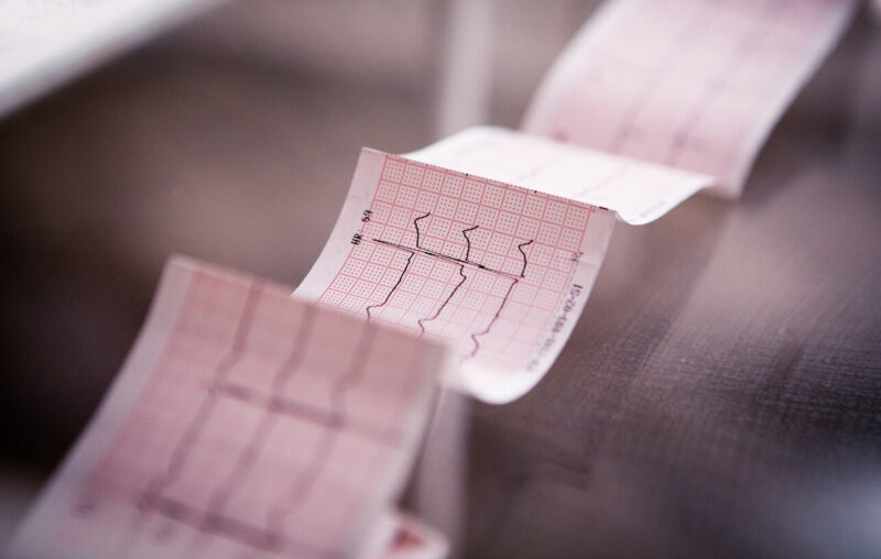 Разработан кардиограф, который сам расшифрует кардиограмму без квалифицированного врача