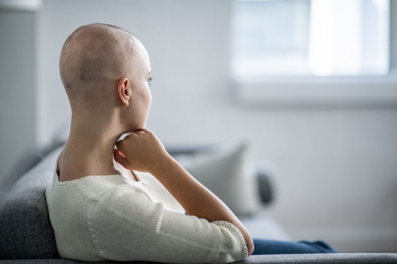Новый метод лечения рака исключает выпадение волос