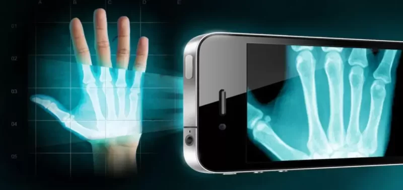 «Рентгеновское зрение»: в смартфонах может появиться новый функционал